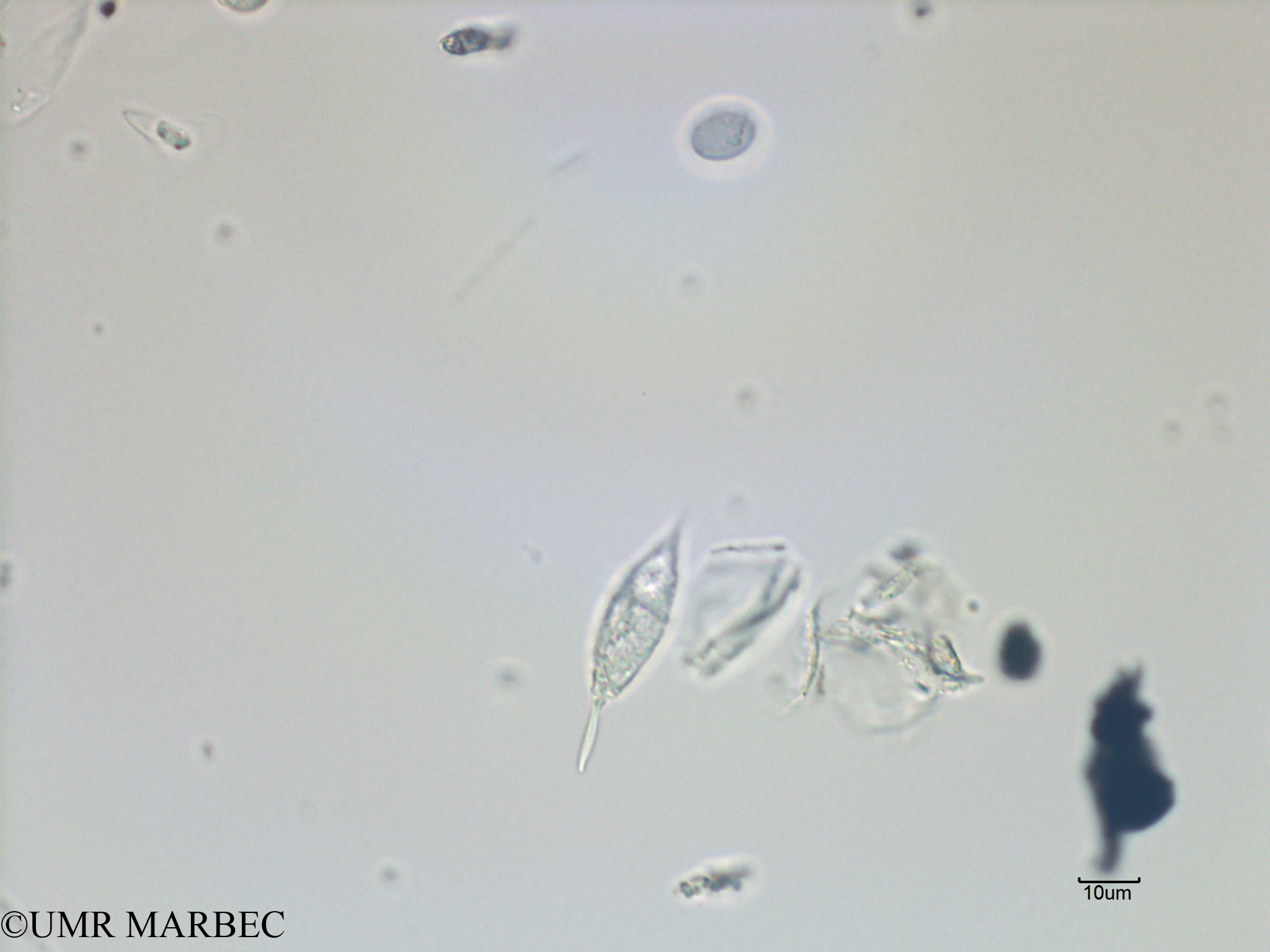 phyto/French_Polynesia/Arutua/ECOPE Janvier 2017/Pronoctiluca spinifera (C1A_S1R2_050117_gracile).tif(copy).jpg